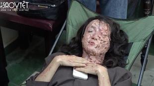 Bí mật đằng sau gương mặt bị tạt acid, cô gái bị phóng dao vào mặt trong ‘Chuyện Ma Gần Nhà’